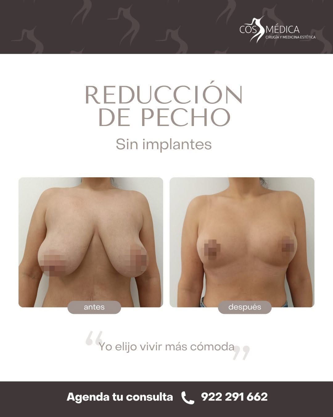 Post 4 by ✨Cosmédica Tenerife ✨ on Instagram (image)