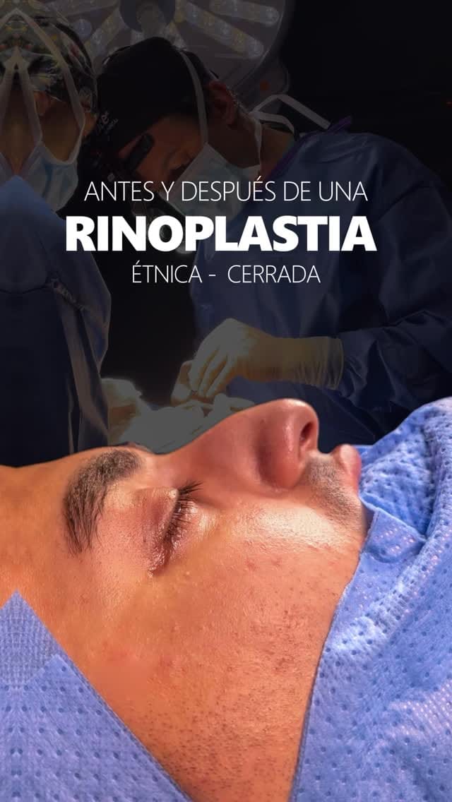 Post 8 by Dr Marco Romeo on Instagram (video)