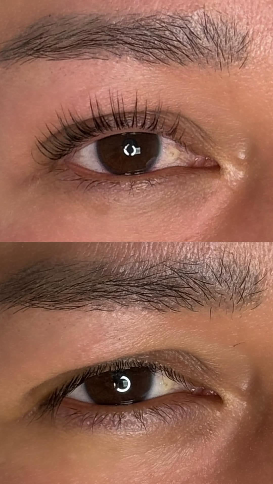 Post 1 by Clariss Centro Médico Estético on Instagram (video)