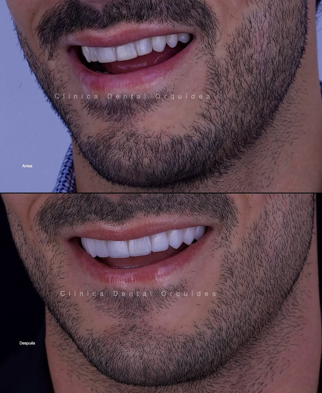 Post 1 by Orquidea Dental 🇻🇪🇪🇸 on Instagram (carousel)