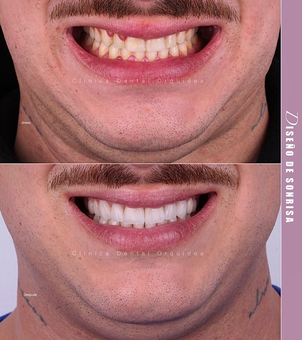 Post 9 by Orquidea Dental 🇻🇪🇪🇸 on Instagram (image)
