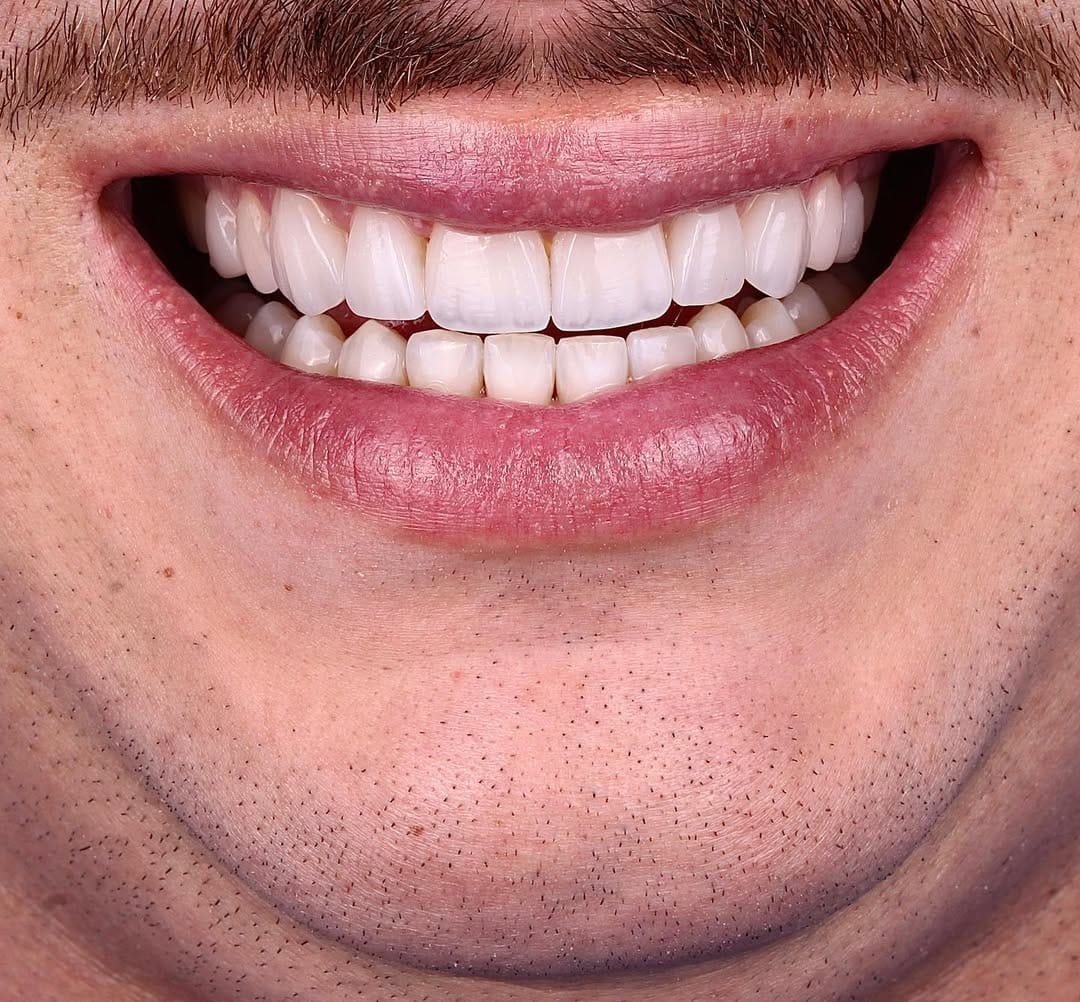 Post 8 by Orquidea Dental 🇻🇪🇪🇸 on Instagram (carousel)