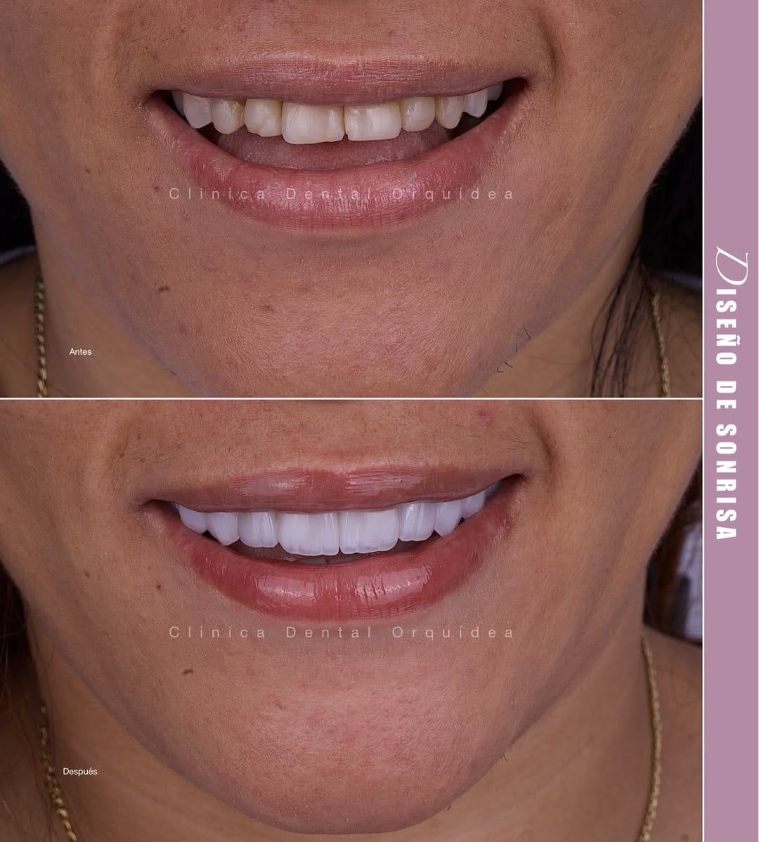 Post 3 by Orquidea Dental 🇻🇪🇪🇸 on Instagram (image)