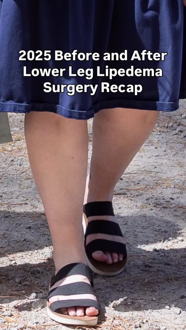 Post 7 by Dr. Burgos de la Obra - Lipemedical team on Instagram (video)