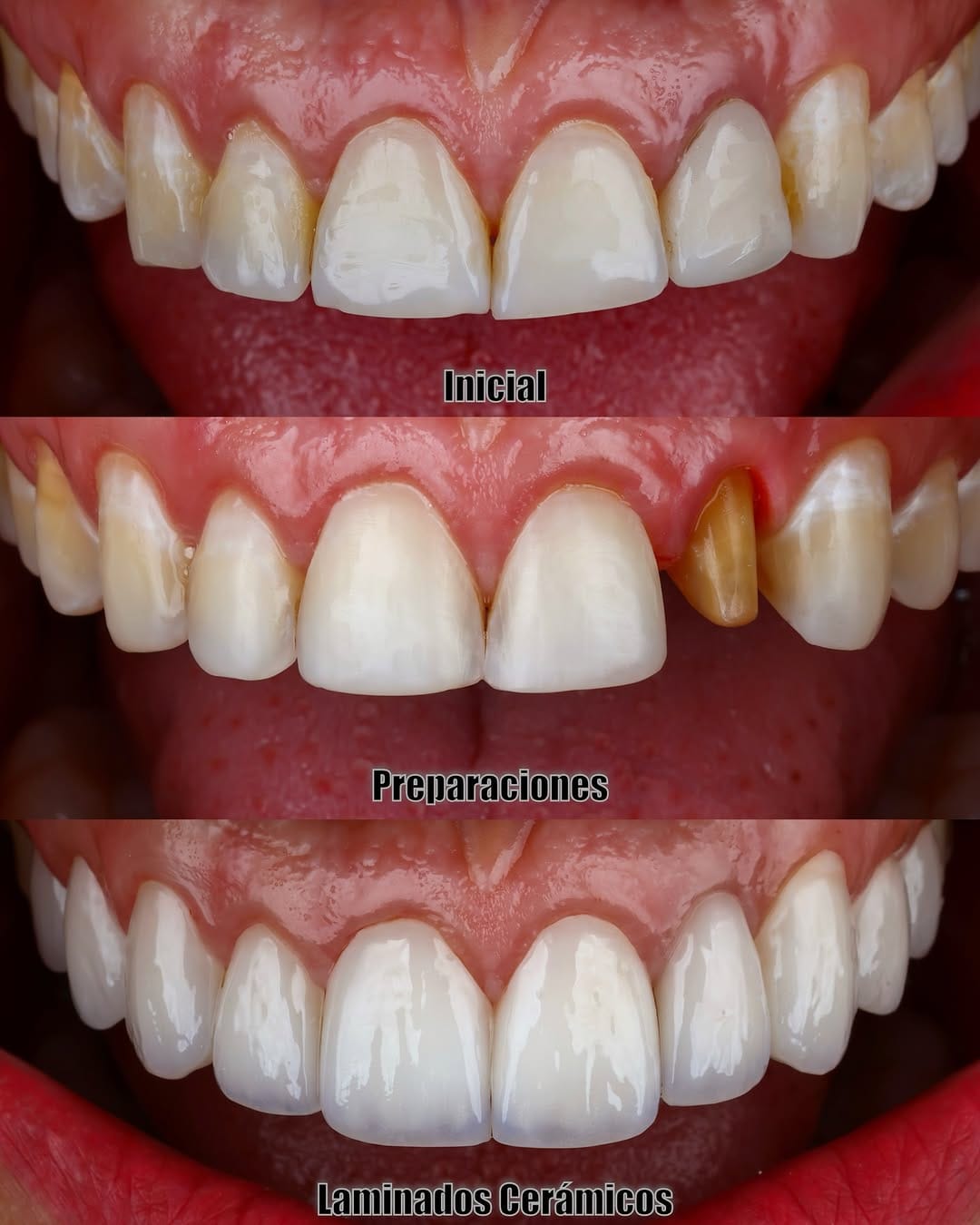 Post 1 by Miguel Madrid  | Odontólogo | Filosofía BOPT | Fotografía dental on Instagram (image)