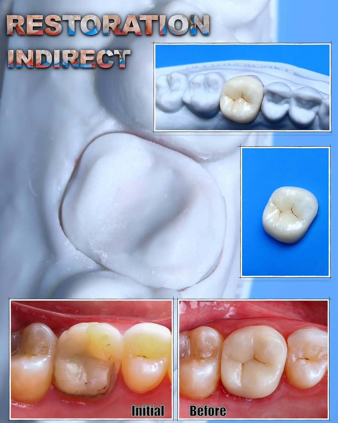 Post 7 by Miguel Madrid  | Odontólogo | Filosofía BOPT | Fotografía dental on Instagram (image)