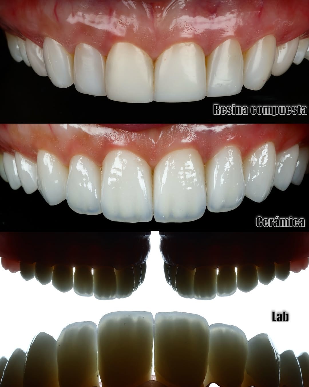 Post 4 by Miguel Madrid  | Odontólogo | Filosofía BOPT | Fotografía dental on Instagram (carousel)