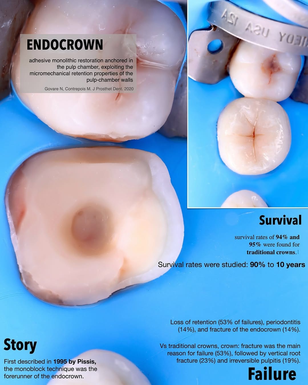 Post 9 by Miguel Madrid  | Odontólogo | Filosofía BOPT | Fotografía dental on Instagram (carousel)