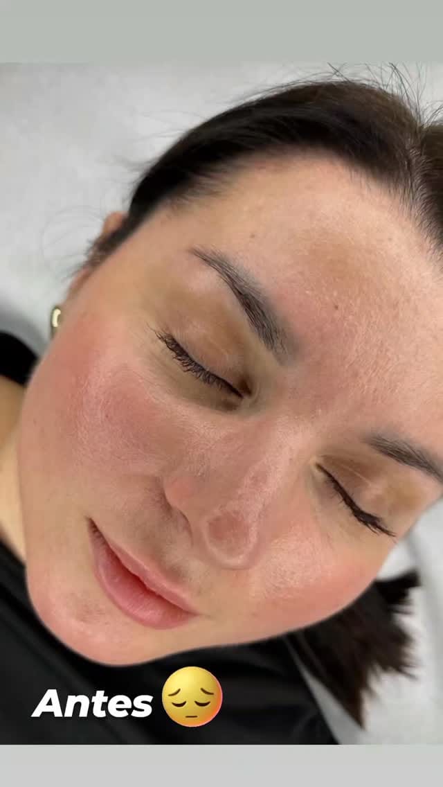 Post 1 by micropigmentación armenia on Instagram (video)