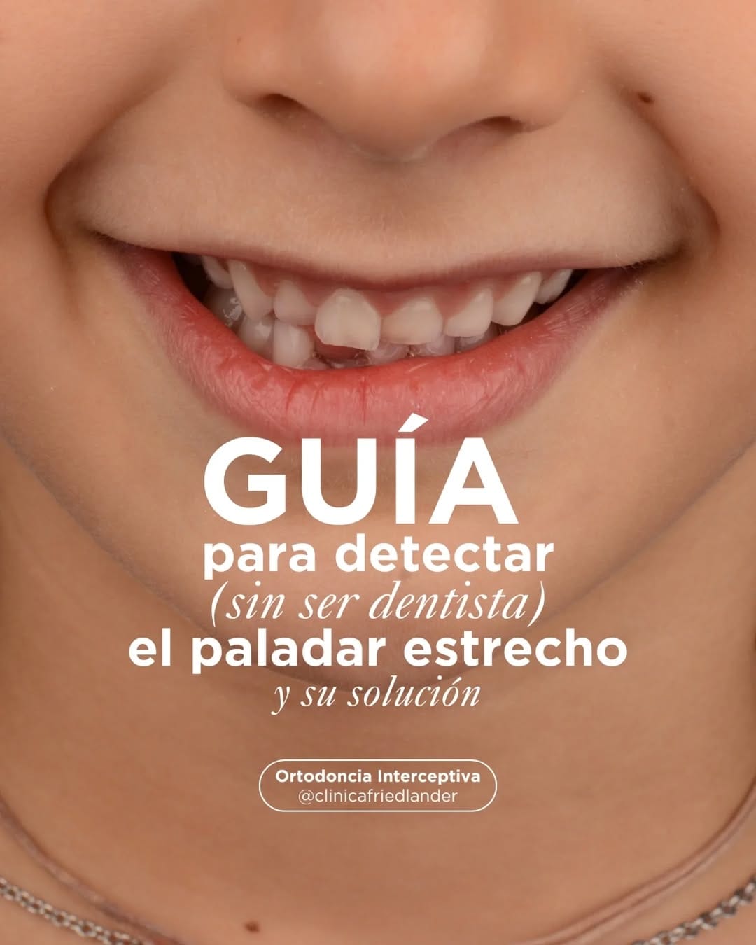 Post 10 by Friedländer Clínica Dental en Barcelona on Instagram (carousel)