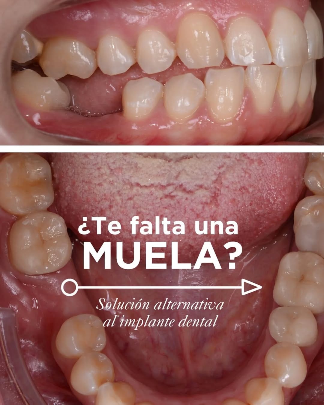 Post 6 by Friedländer Clínica Dental en Barcelona on Instagram (carousel)