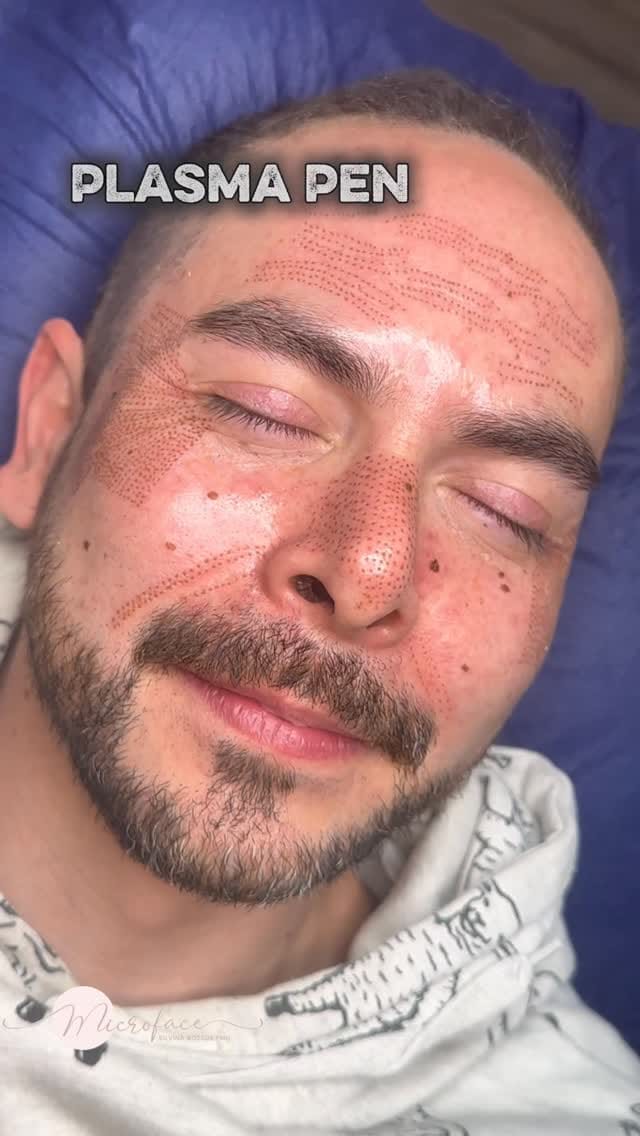 Post 7 by 𝑺𝒊𝒍𝒗𝒊𝒏𝒂 𝑩𝒐𝒔𝒔𝒖𝒔 | Microblading | Micropigmentación | BB GLOW on Instagram (video)