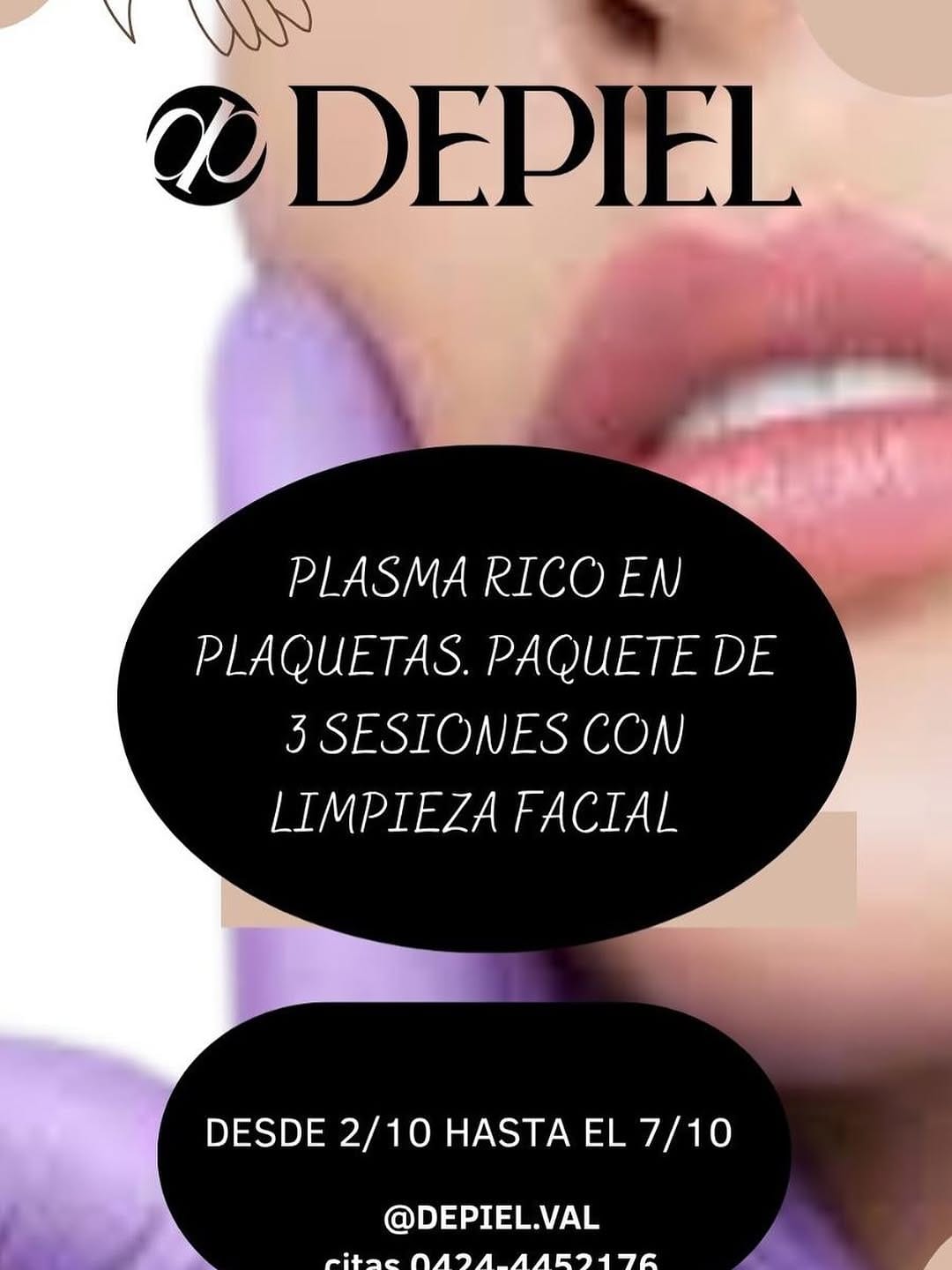 Post 9 by Depiel Chimeneas on Instagram (image)