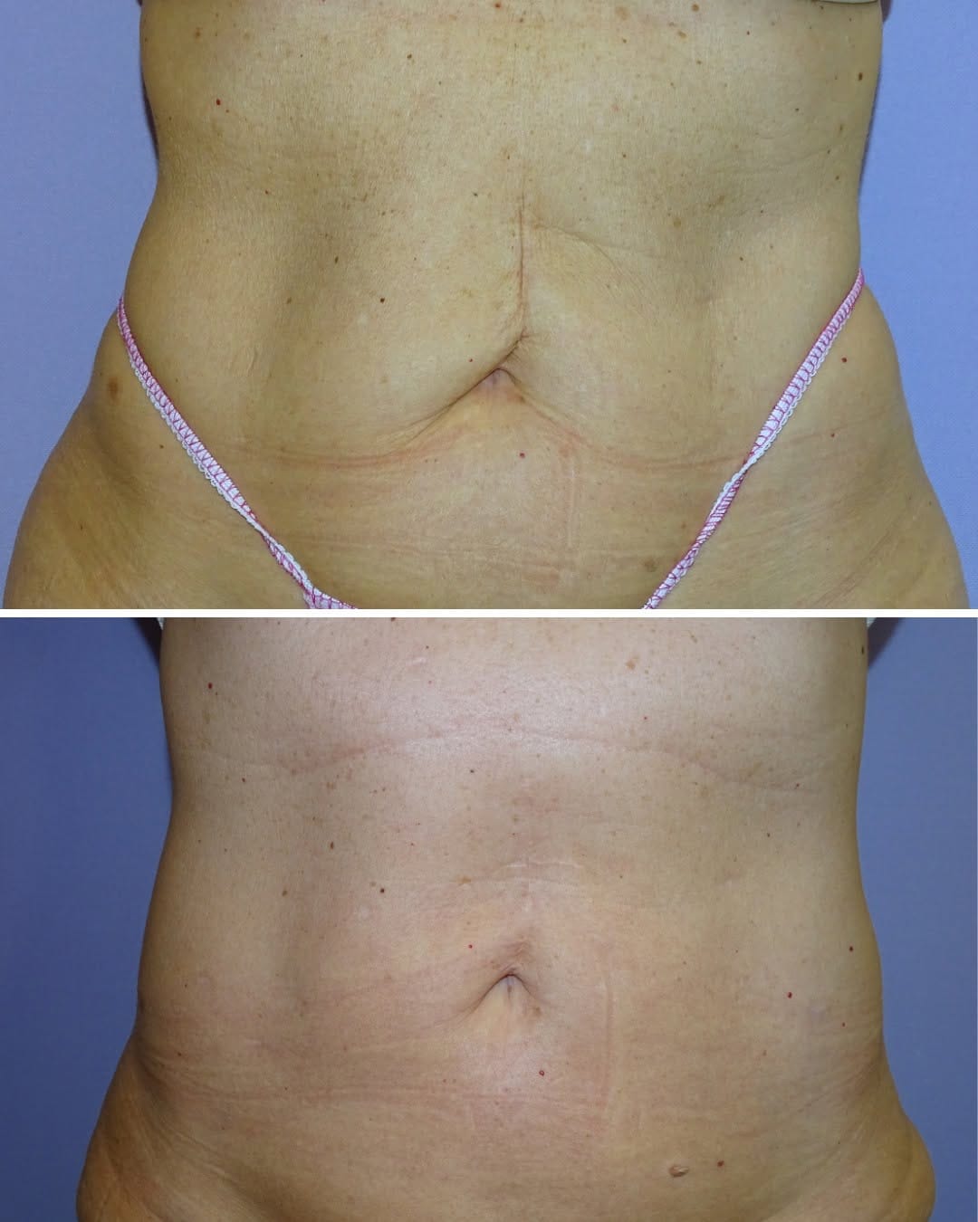 Post 1 by Instituto Médico Miramar | Medicina y cirugía Estética on Instagram (carousel)