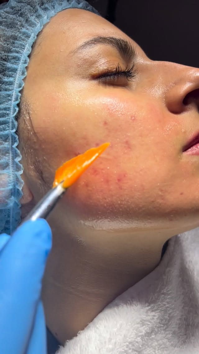 Post 2 by Instituto Médico Miramar | Medicina y cirugía Estética on Instagram (video)