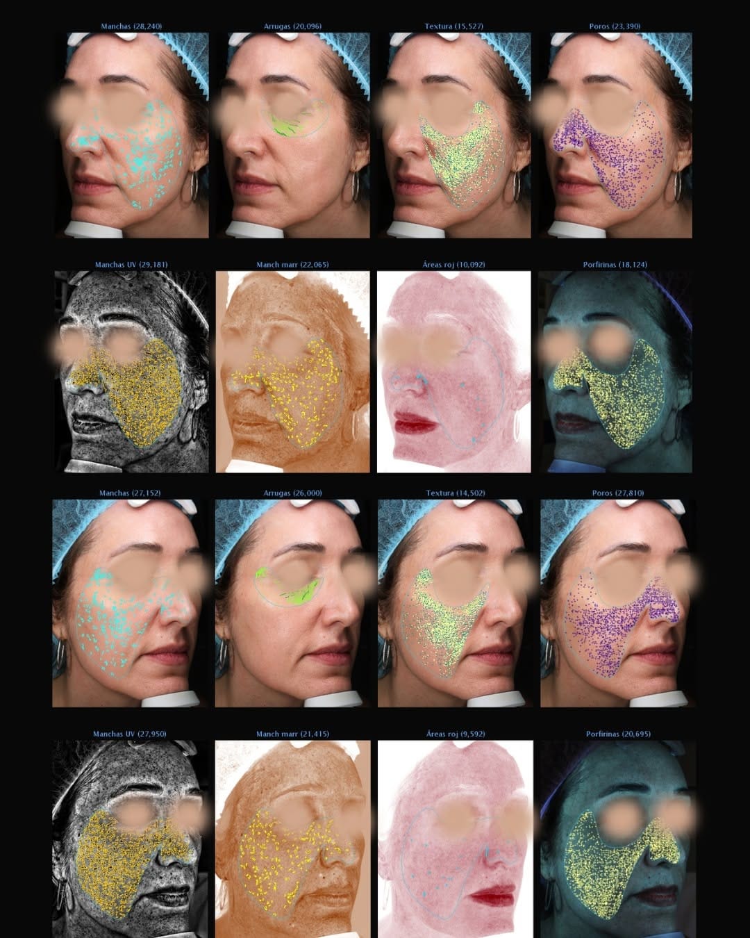 Post 6 by Instituto Médico Miramar | Medicina y cirugía Estética on Instagram (carousel)