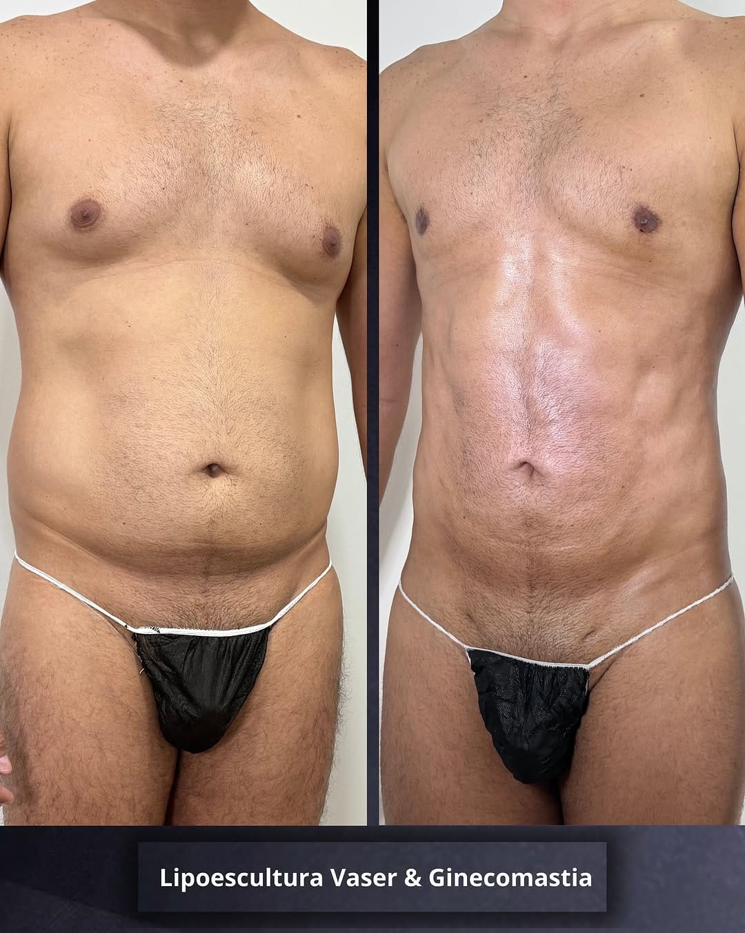 Post 9 by Dr. Deivys Higuerey / Medicina y Cirugía Estética on Instagram (carousel)
