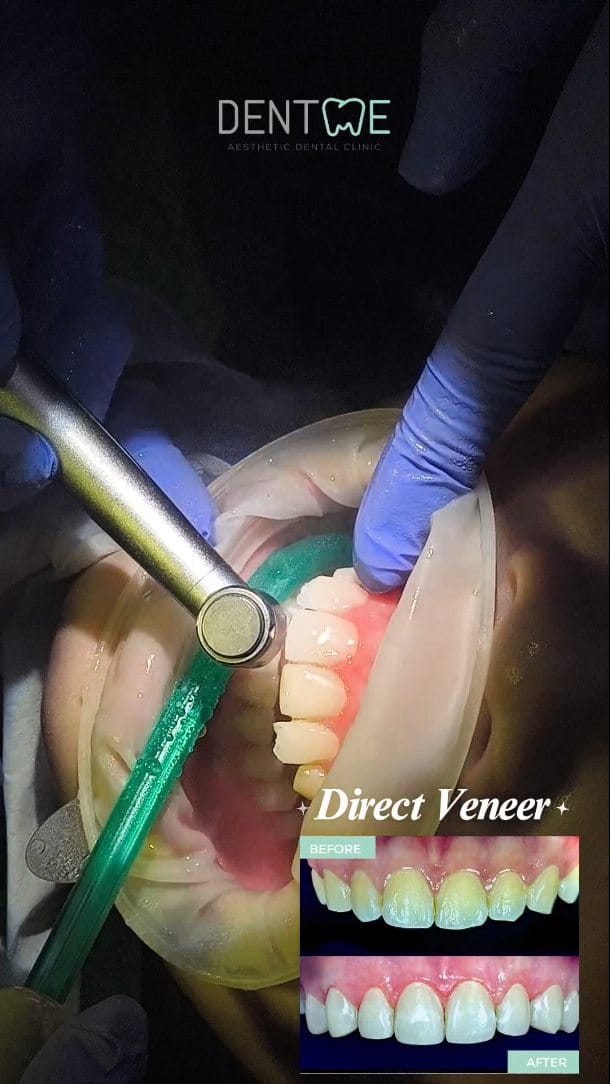 Post 1 by drg. Alicia Surya on Instagram (video)