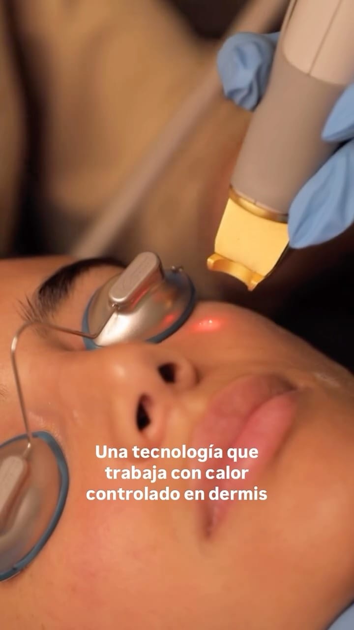 Post 2 by Clínica Olalla Álvarez Aesthetic Medicine | Art of Beauty on Instagram (video)