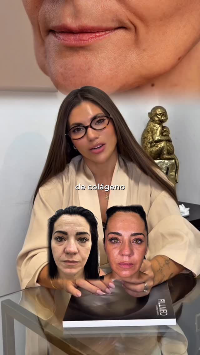 Post 5 by Clínica Olalla Álvarez Aesthetic Medicine | Art of Beauty on Instagram (video)