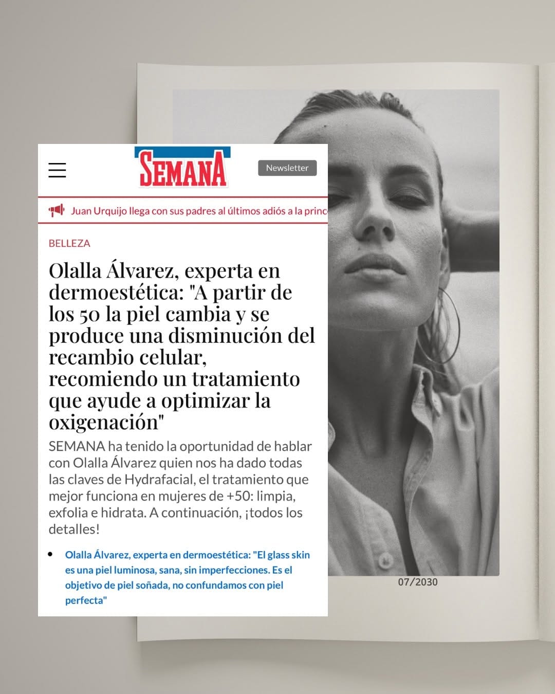 Post 3 by Clínica Olalla Álvarez Aesthetic Medicine | Art of Beauty on Instagram (carousel)