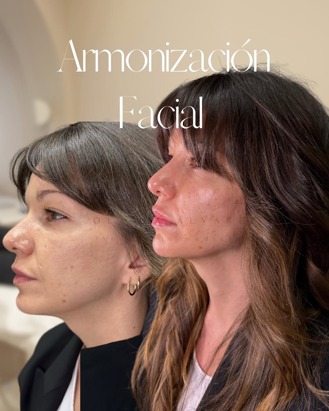 Post 1 by Clínica Olalla Álvarez Aesthetic Medicine | Art of Beauty on Instagram (image)