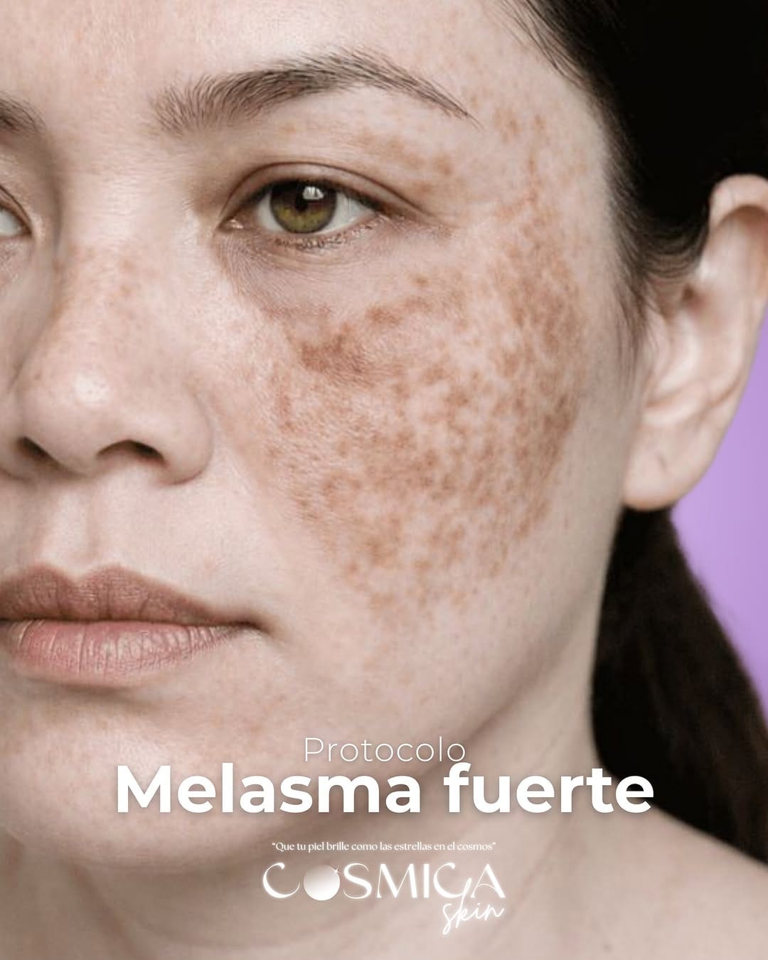 Post 6 by Cosmica Skin on Instagram (carousel)