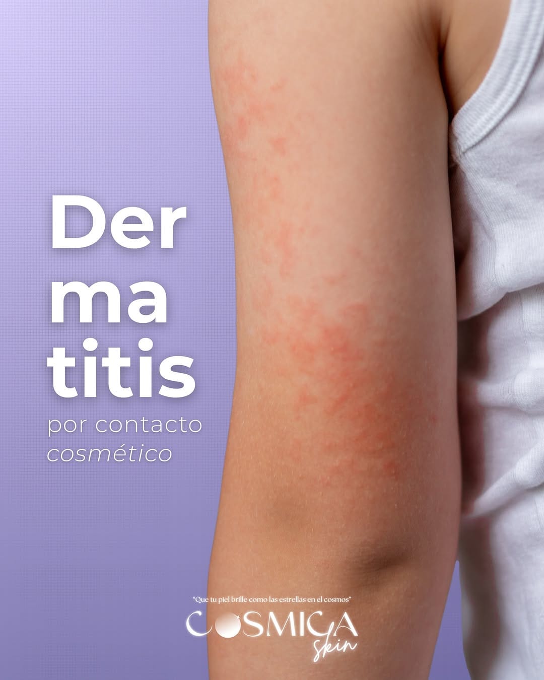 Post 9 by Cosmica Skin on Instagram (carousel)
