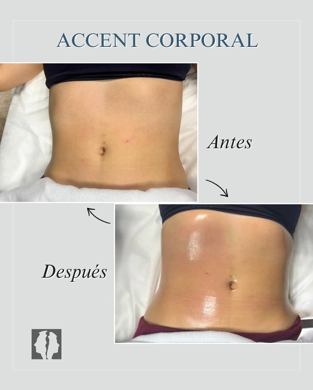 Post 3 by Dr. Roberto Manzano Fletes | Medicina Estética on Instagram (image)