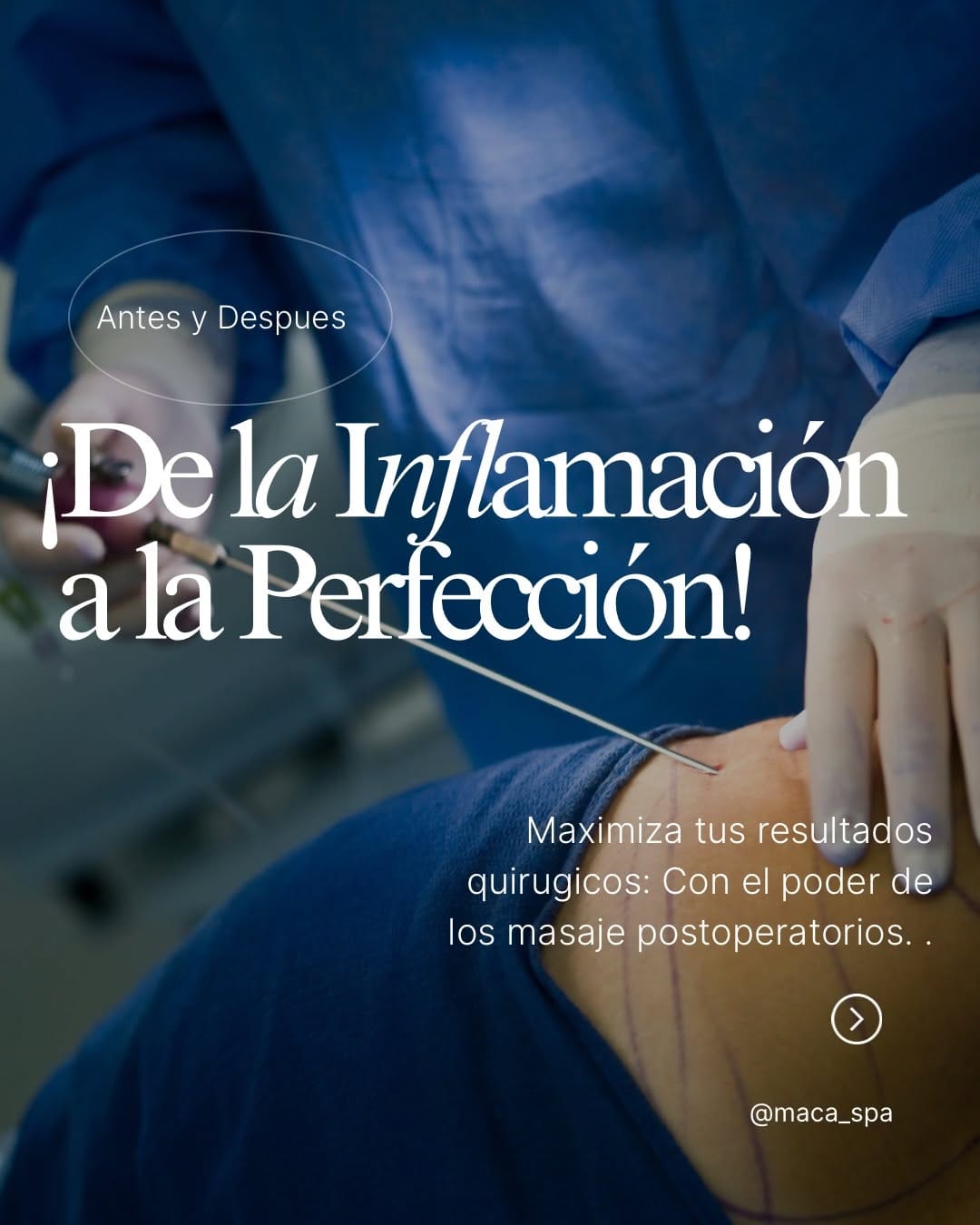 Post 4 by MACA Aesthetic & SPA |Depilación|Masajes| Post Operatorio on Instagram (carousel)