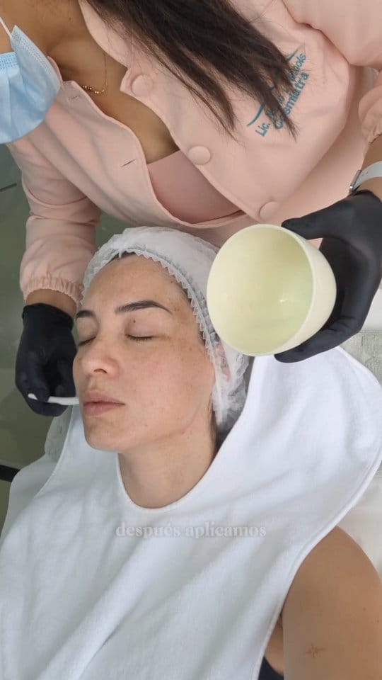 Post 5 by Benessere Medicina Estética on Instagram (video)