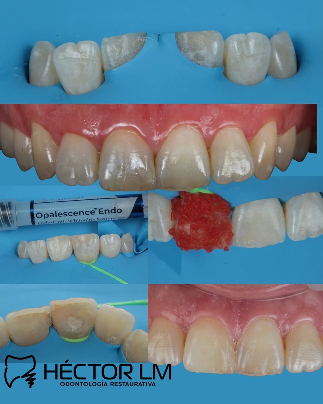 Post 10 by Vamasa Health Innovation on Instagram (image)