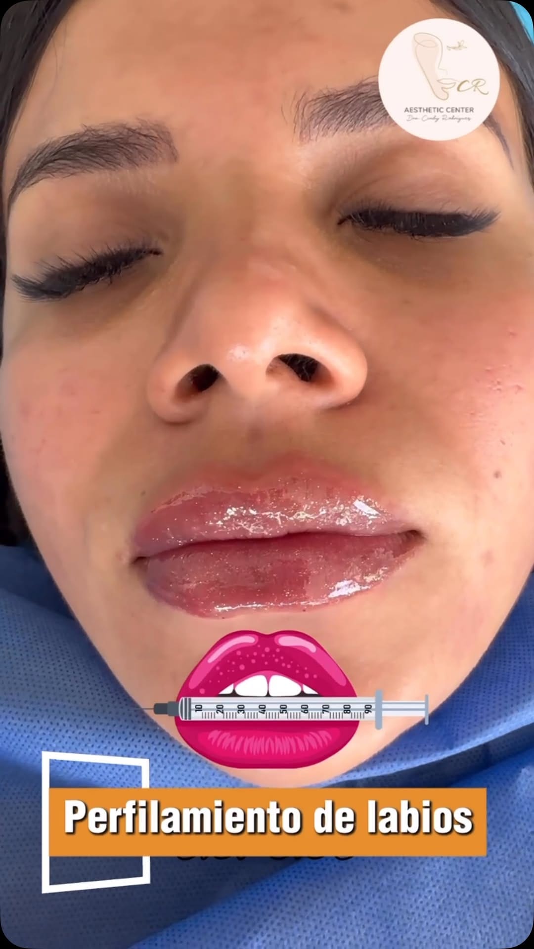 Post 5 by CR AESTHETICS CENTER on Instagram (video)