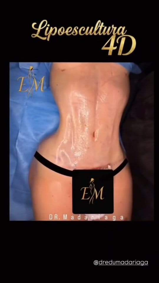 Post 5 by Dr.Eduardo Madariaga on Instagram (video)