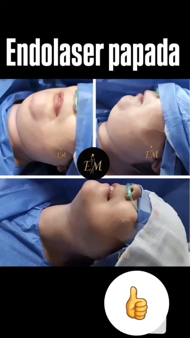 Post 2 by Dr.Eduardo Madariaga on Instagram (video)
