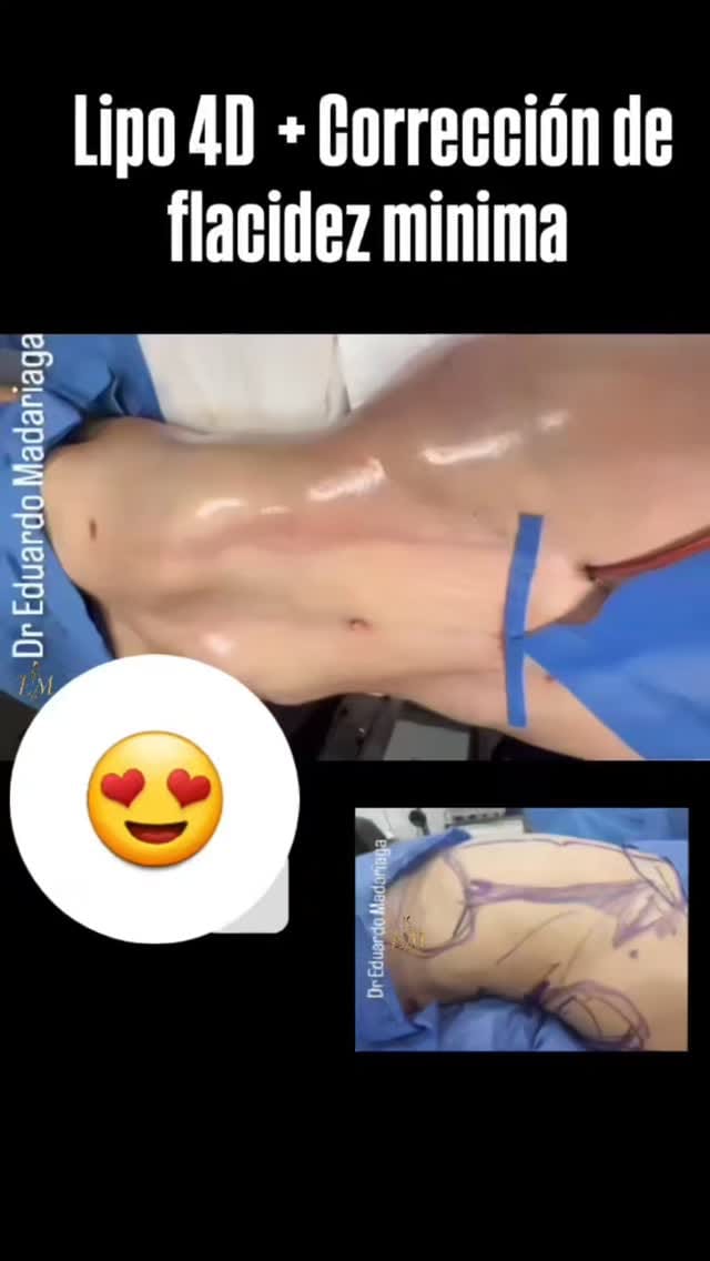 Post 8 by Dr.Eduardo Madariaga on Instagram (video)