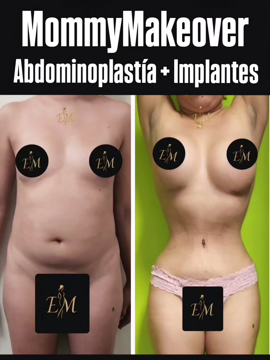 Post 3 by Dr.Eduardo Madariaga on Instagram (image)