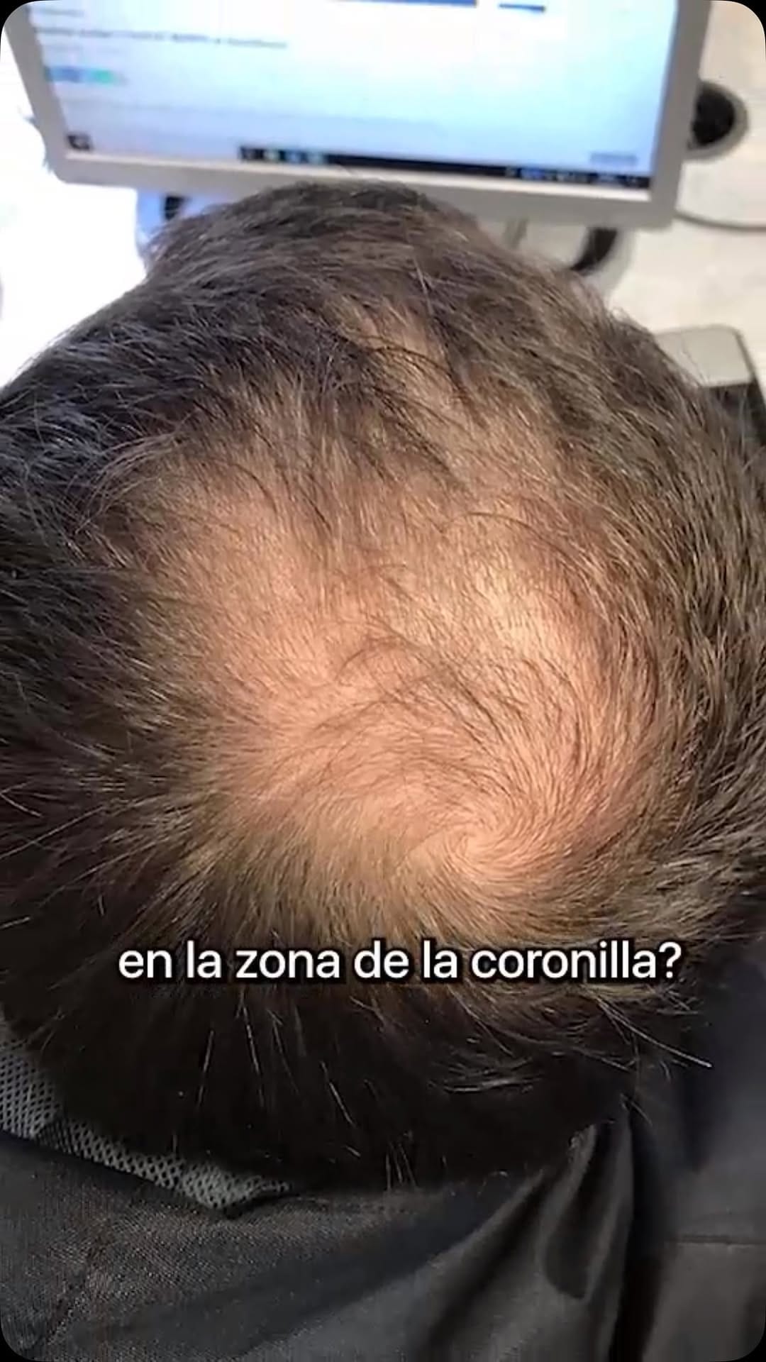 Post 10 by 𝕷𝖚𝖒𝖇𝖊𝖆𝖗𝖉 on Instagram (video)