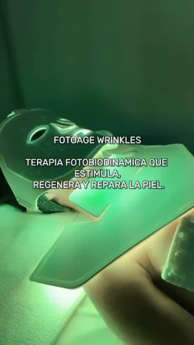 Post 7 by Clínica MOS on Instagram (video)