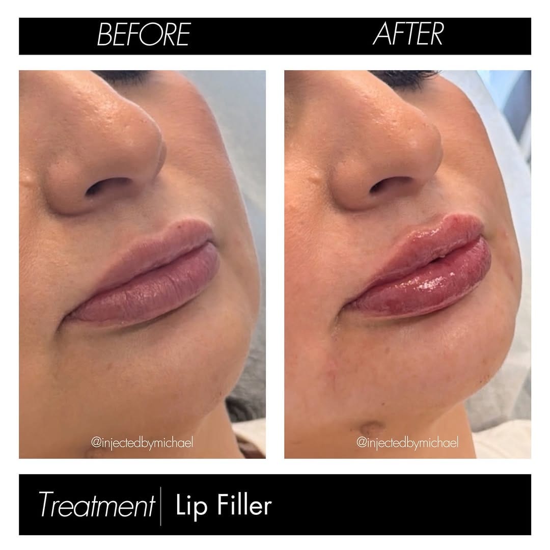Post 6 by 𝐂𝐇𝐑𝐎𝐌𝐄 𝐌𝐞𝐝𝐢𝐜𝐚𝐥 𝐀𝐞𝐬𝐭𝐡𝐞𝐭𝐢𝐜𝐬 | ᴀʟʙᴜǫᴜᴇʀǫᴜᴇ on Instagram (carousel)