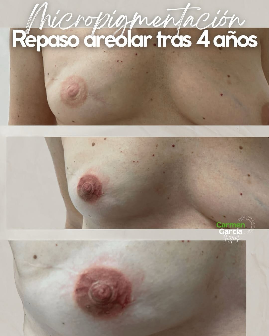 Post 2 by Carmen Garcia Retorta on Instagram (image)