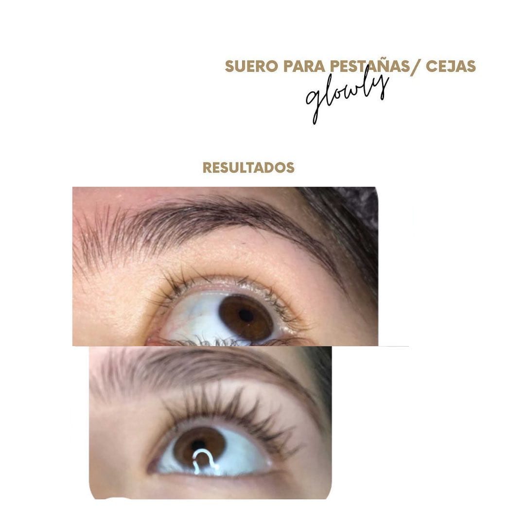 Post 8 by Glowly Natural Beauty on Instagram (carousel)