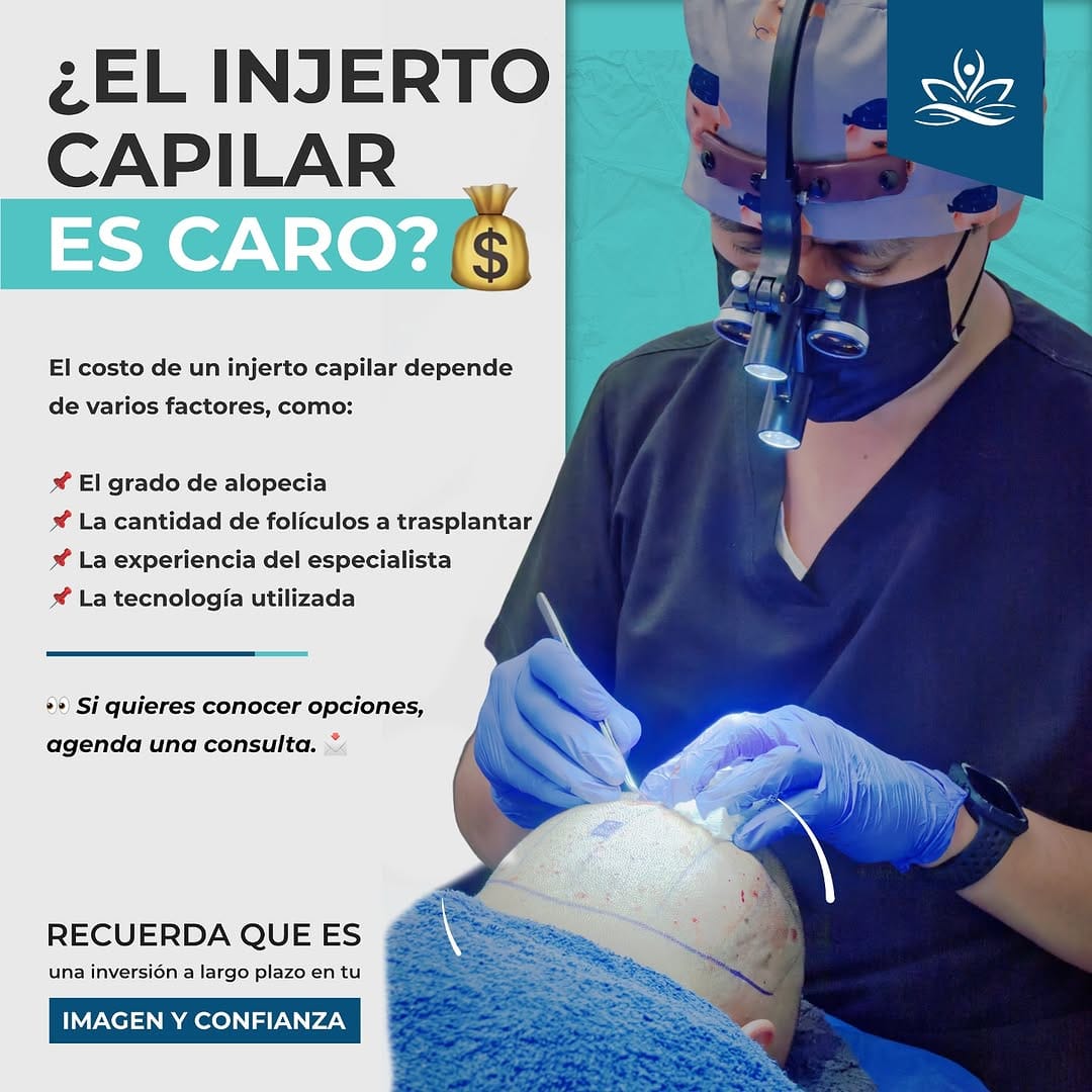 Post 6 by Transplante Capilar y Tricología on Instagram (image)