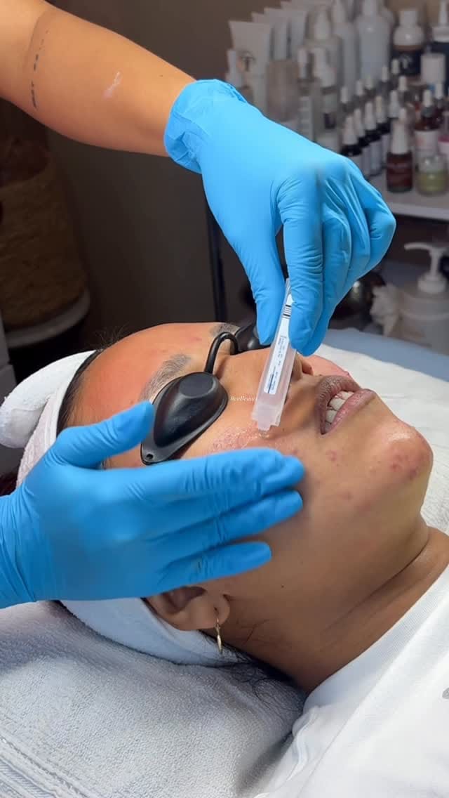Post 1 by Ren Beauty✨ on Instagram (video)