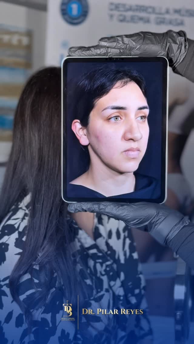 Post 4 by Maria Del Pilar Reyes Aguero on Instagram (video)