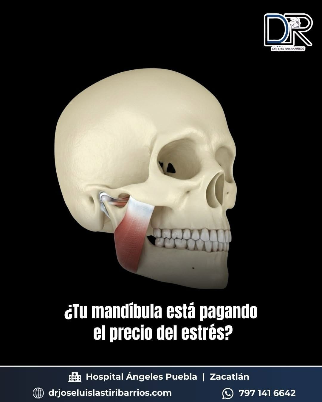 Post 4 by Dr. José Luis Lastiri Barrios on Instagram (carousel)