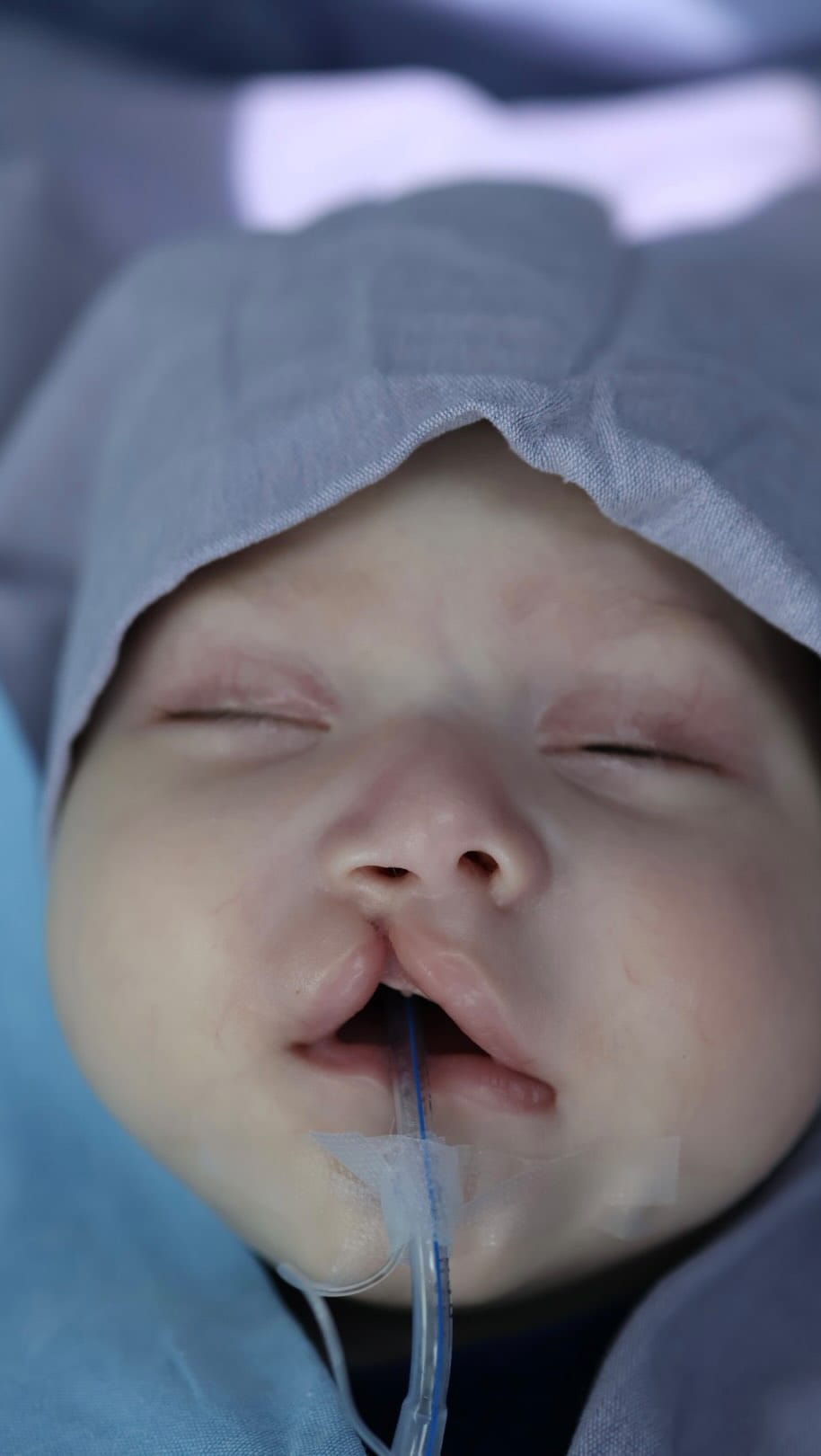 Post 1 by Dr. José Luis Lastiri Barrios on Instagram (video)