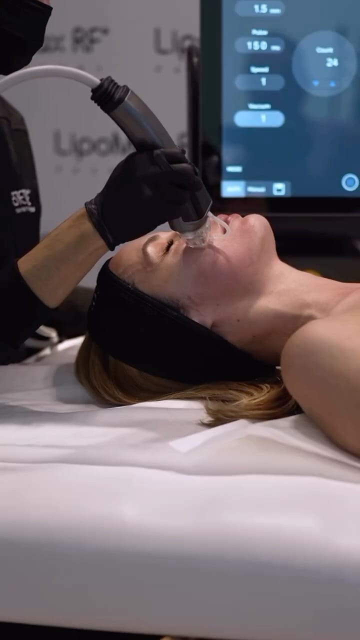 Post 6 by Estetique® USA on Instagram (video)