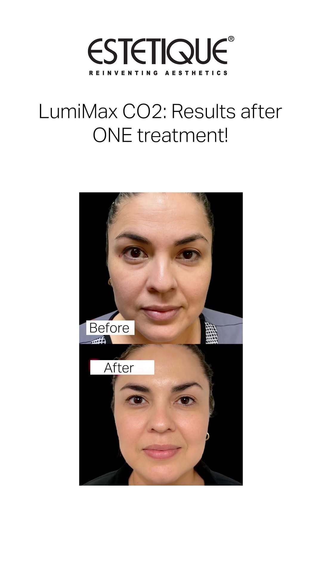 Post 10 by Estetique® USA on Instagram (video)