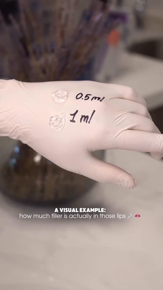 Post 8 by Gaia Mkrtchyan| Nurse Practitioner | Aesthetic Procedures on Instagram (video)